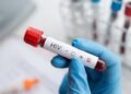 Fiji declares national HIV emergency as nation grapples with surge in cases